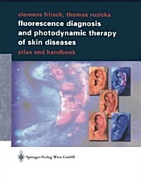 Fluorescence Diagnosis and Photodynamic Therapy of Skin Diseases: Atlas and Handbook (Paperback, Softcover Repri)