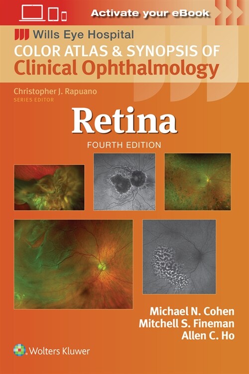 Retina (Paperback, 4)