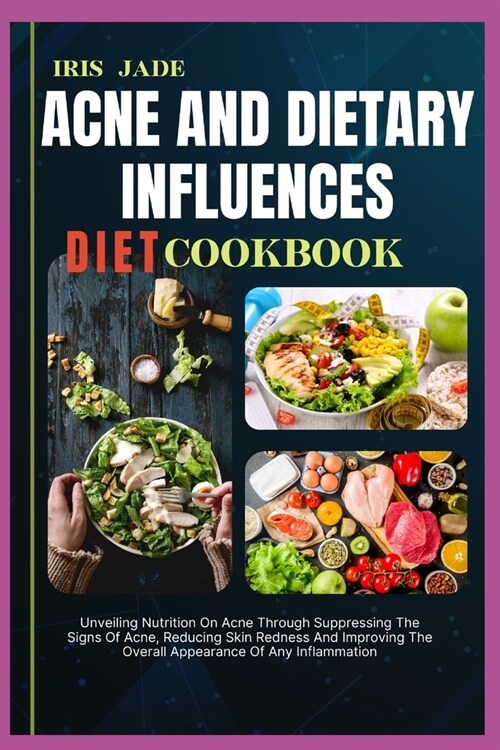 Acne and Dietary Influences Diet Cook Book: Unveiling Nutrition On Acne Through Suppressing The Signs Of Acne, Reducing Skin Redness And Improving The (Paperback)