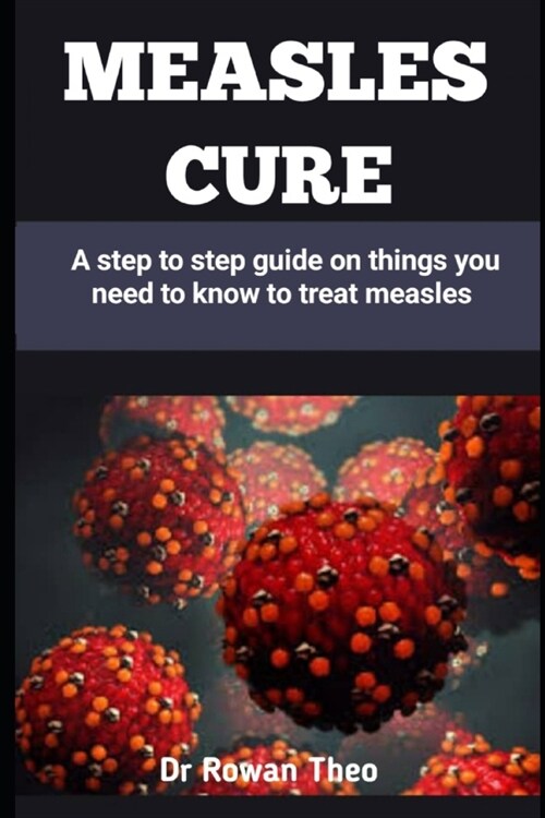 Measles Cure: A step to step guide on things you need to know to treat measles (Paperback)