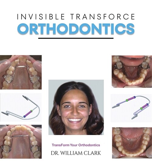 Invisible TransForce Orthodontics (Hardcover)