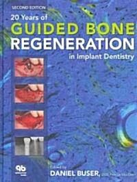 20 Years of Guided Bone Regeneration in Implant Dentistry (Hardcover, 2)