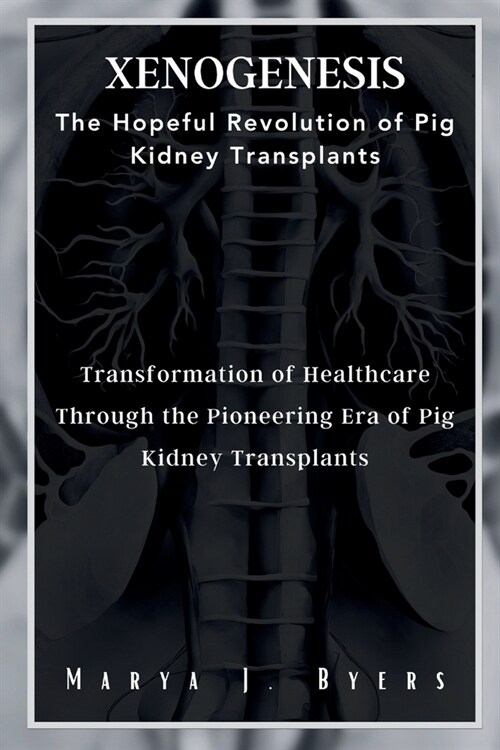 XenoGenesis The Hopeful Revolution of Pig Kidney Transplants: Transformation of Healthcare Through the Pioneering Era of Pig Kidney Transplants (Paperback)