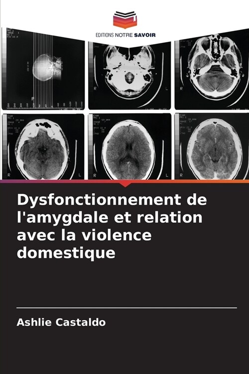 Dysfonctionnement de lamygdale et relation avec la violence domestique (Paperback)