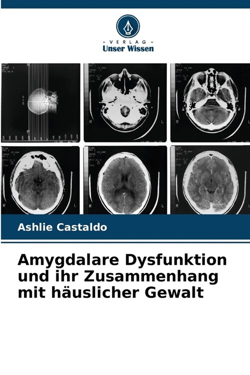 Amygdalare Dysfunktion und ihr Zusammenhang mit h?slicher Gewalt (Paperback)