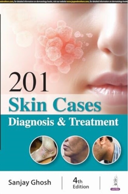 201 Skin Cases : Diagnosis & Treatment (Paperback, 4 Revised edition)