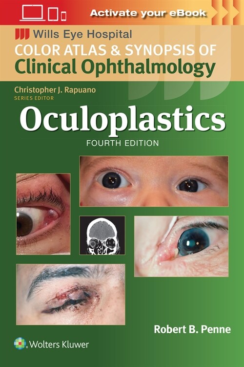 Oculoplastics (Paperback, 4)