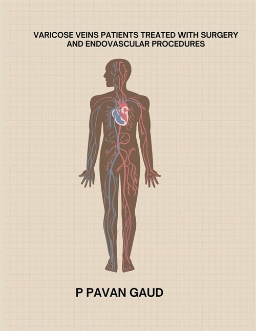 Varicose Veins Patients Treated with Surgery and Endovascular Procedures (Paperback)