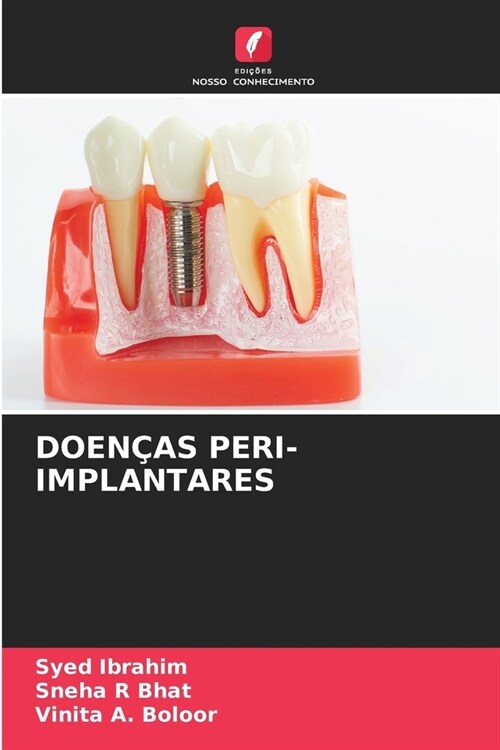 Doen?s Peri-Implantares (Paperback)