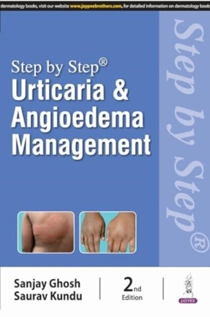Step by Step: Urticaria & Angioedema Management (Paperback, 2 Revised edition)