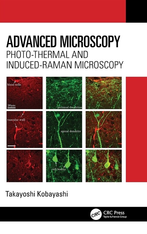 Advanced Microscopy : Photo-Thermal and Induced-Raman Microscopy (Hardcover)