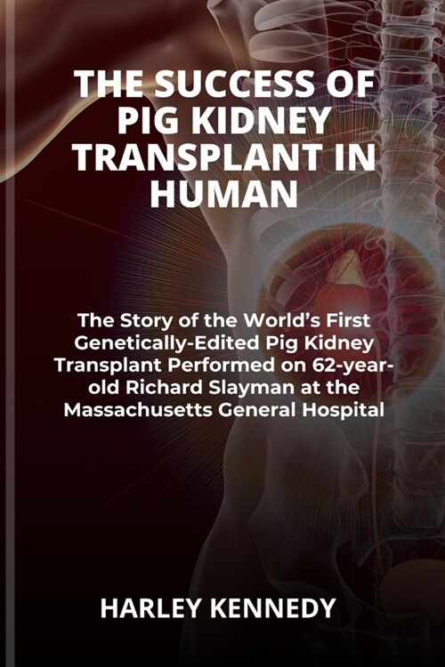The Success of Pig Kidney Transplant in Human: The Story of the Worlds First Genetically-Edited Pig Kidney Transplant Performed on 62-year-old Richar (Paperback)
