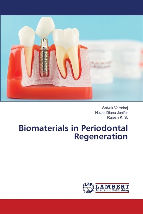 Biomaterials in Periodontal Regeneration (Paperback)