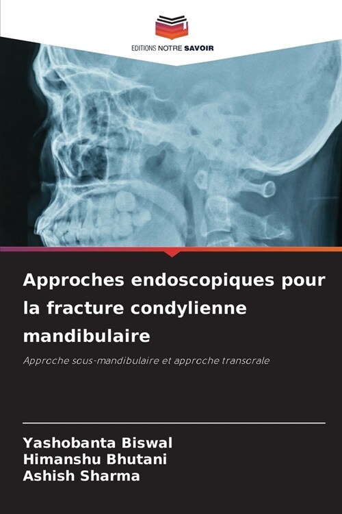 Approches endoscopiques pour la fracture condylienne mandibulaire (Paperback)