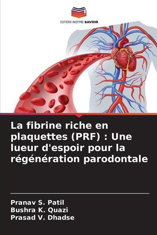 La fibrine riche en plaquettes (PRF): Une lueur despoir pour la r???ation parodontale (Paperback)