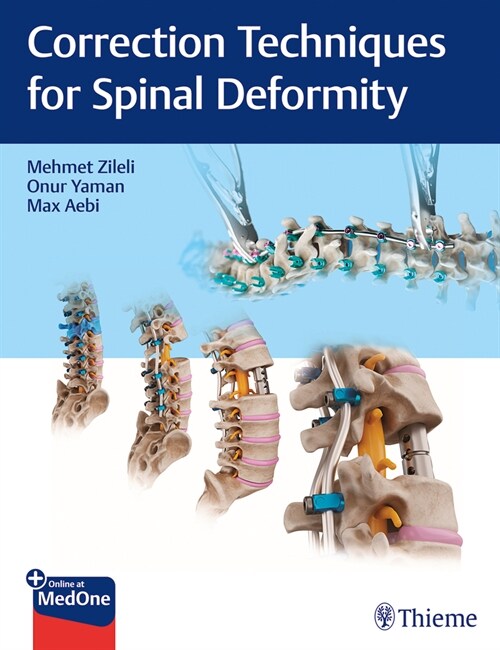 Correction Techniques for Spinal Deformity (Hardcover)