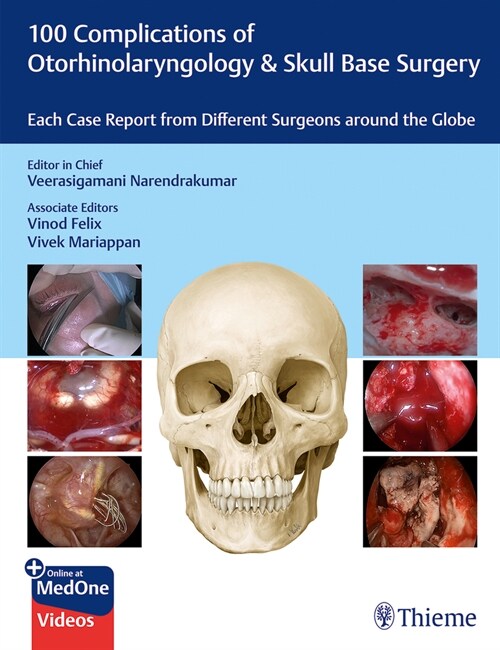 100 Complications of Otorhinolaryngology & Skull Base Surgery: Each Case Report from Different Surgeons Around the Globe (Hardcover)