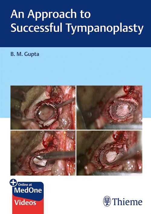 An Approach to Successful Tympanoplasty (Hardcover)