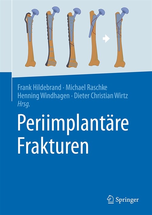 Periimplant?e Frakturen (Hardcover, 2025)