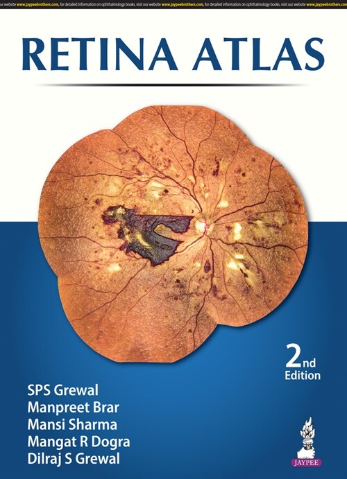 Retina Atlas (Hardcover, 2 Revised edition)