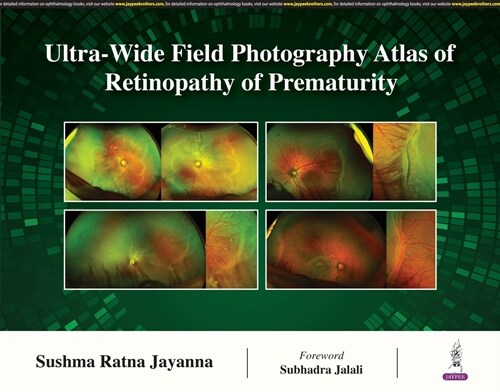 Ultra-Wide Field Photography Atlas of Retinopathy of Prematurity (Hardcover)