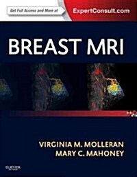 Breast MRI : Expert Consult: Online and Print (Hardcover)