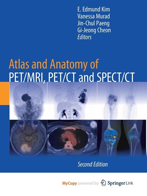Atlas and Anatomy of PET/MRI, PET/CT and SPECT/CT (Paperback)