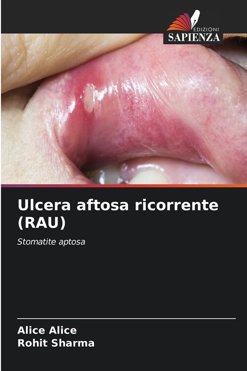 Ulcera aftosa ricorrente (RAU) (Paperback)