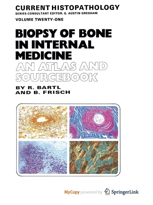 Biopsy of Bone in Internal Medicine (Paperback)