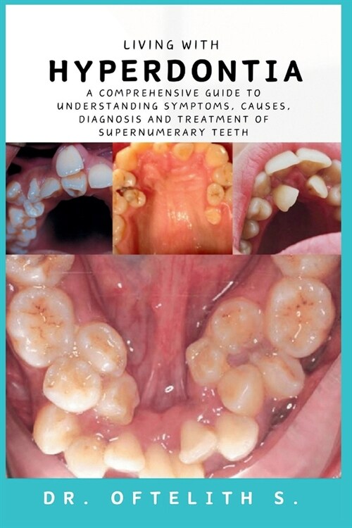 Living with Hyperdontia: A Comprehensive Guide to Understanding Symptoms, Causes, Diagnosis and Treatment of Supernumerary Teeth (Paperback)