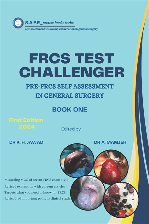 frcs test challenger: pre-frcs self assessment in general surgery (Paperback)