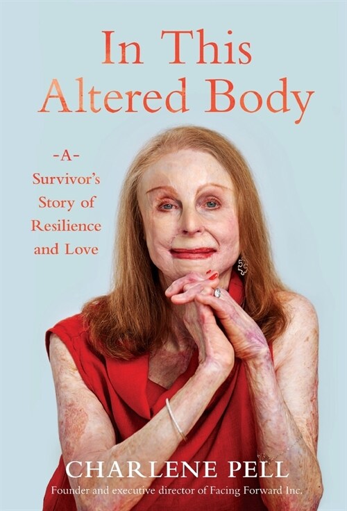 In This Altered Body: A Survivors Story of Resilience and Love (Hardcover)