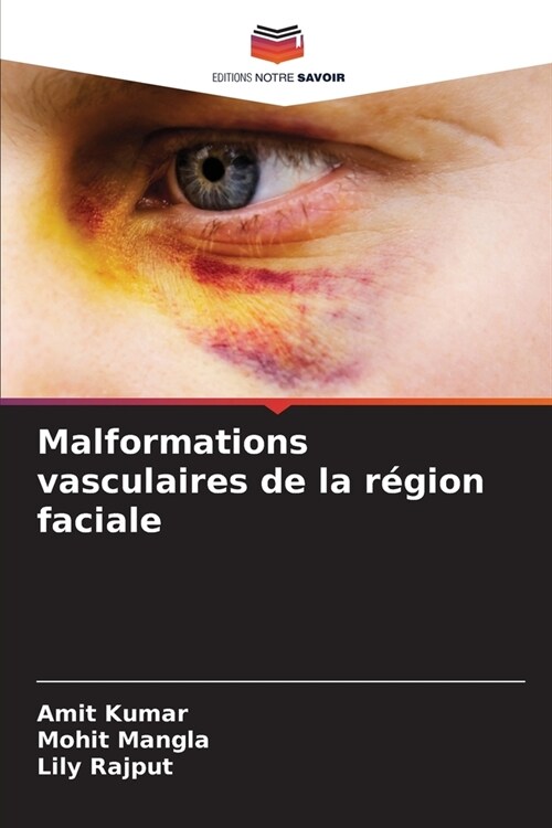 Malformations vasculaires de la r?ion faciale (Paperback)