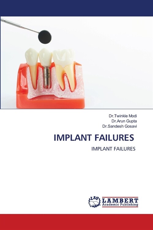 Implant Failures (Paperback)