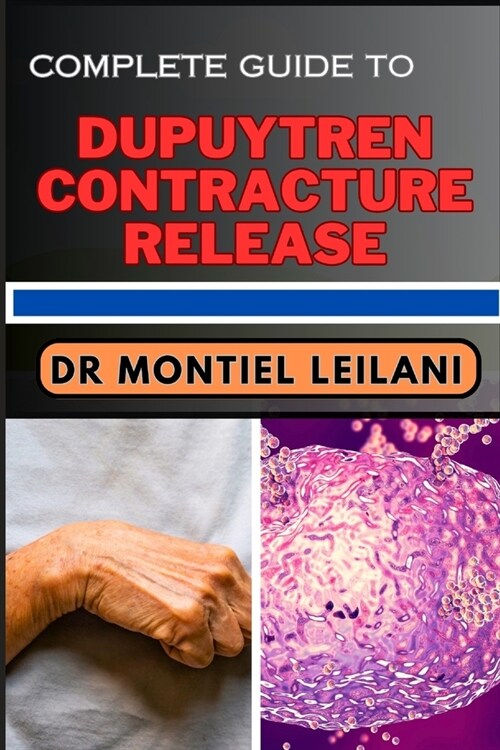 Complete Guide to Dupuytren Contracture Release: Step-By-Step Approach And Strategies On Mastering Mobility And Empowering Recovery (Paperback)