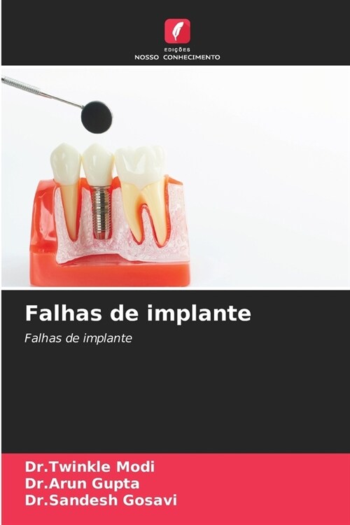 Falhas de implante (Paperback)