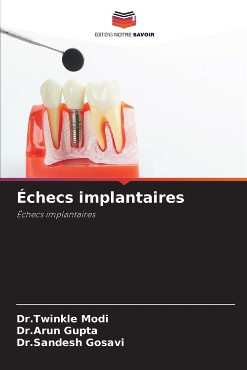 ?hecs implantaires (Paperback)