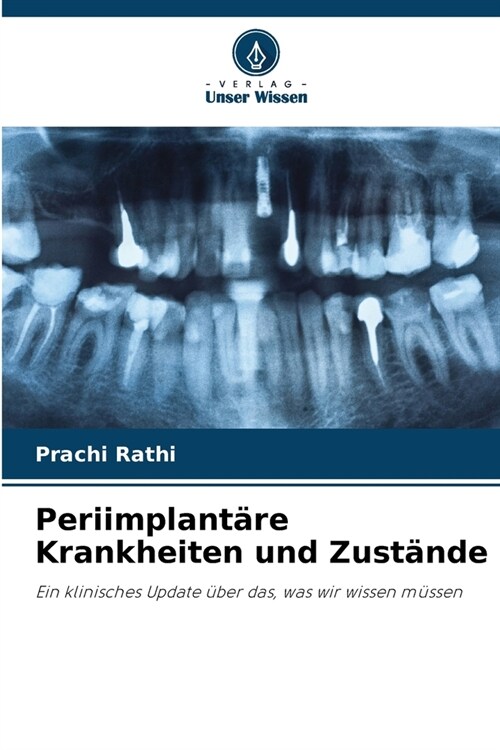 Periimplant?e Krankheiten und Zust?de (Paperback)