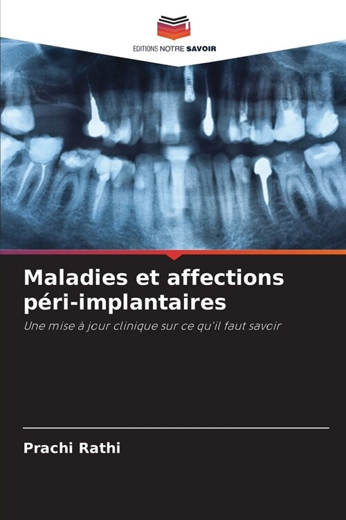 Maladies et affections p?i-implantaires (Paperback)