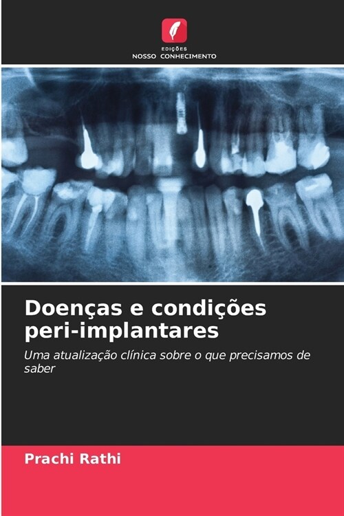 Doen?s e condi寤es peri-implantares (Paperback)