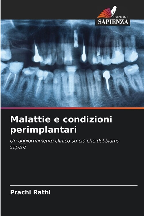 Malattie e condizioni perimplantari (Paperback)