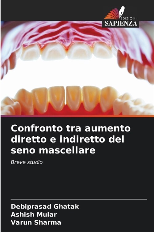 Confronto tra aumento diretto e indiretto del seno mascellare (Paperback)