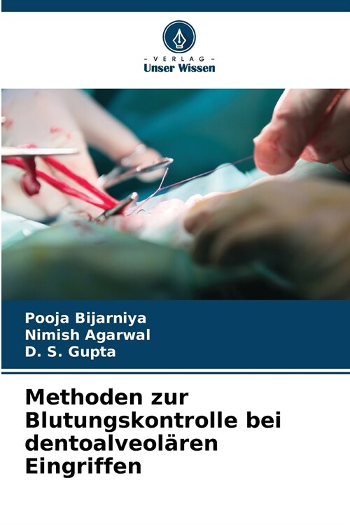 Methoden zur Blutungskontrolle bei dentoalveol?en Eingriffen (Paperback)