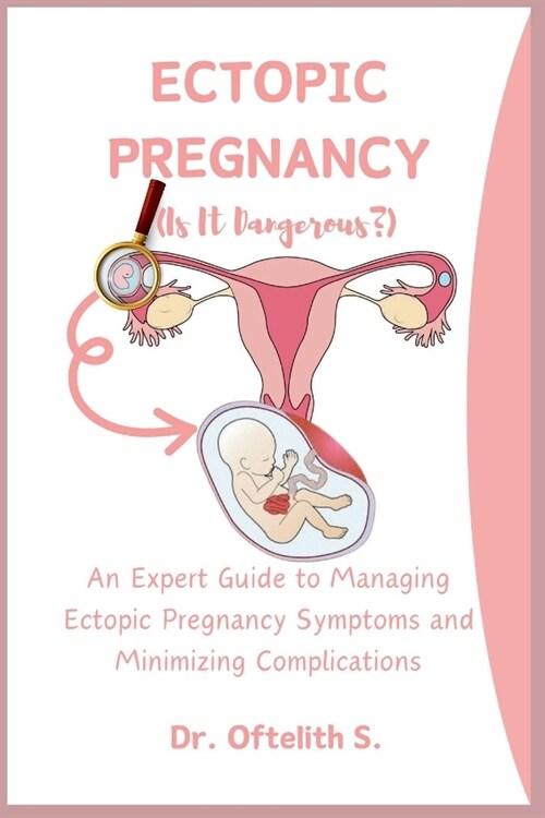 Ectopic Pregnancy: An Expert Guide to Managing Ectopic Pregnancy Symptoms and Minimizing Complications (Paperback)