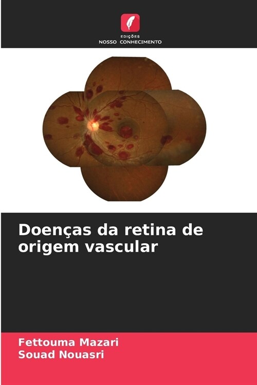 Doen?s da retina de origem vascular (Paperback)
