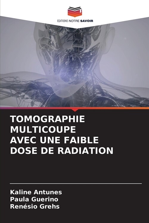 Tomographie Multicoupe Avec Une Faible Dose de Radiation (Paperback)