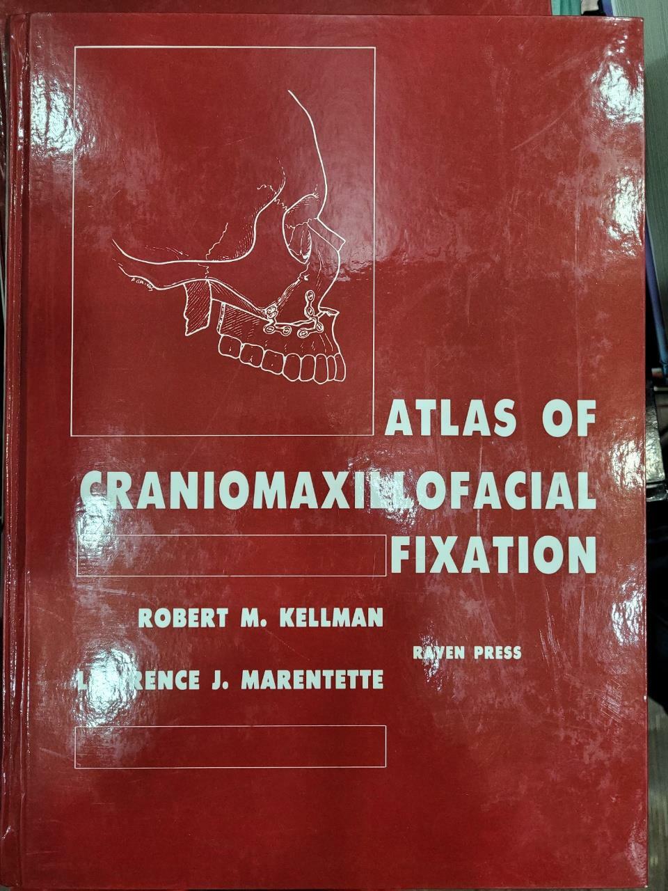 [중고] Atlas of Craniomaxillofacial Fixation (Hardcover)