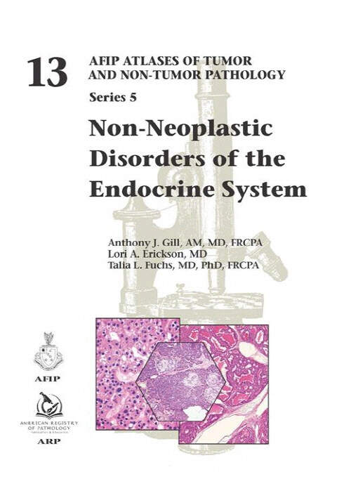 Non-Neoplastic Disorders of the Endocrine System