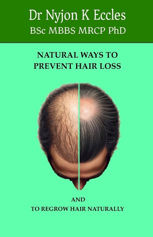 Natural Ways to Prevent Hair Loss: How to regrow hair naturally (Paperback)