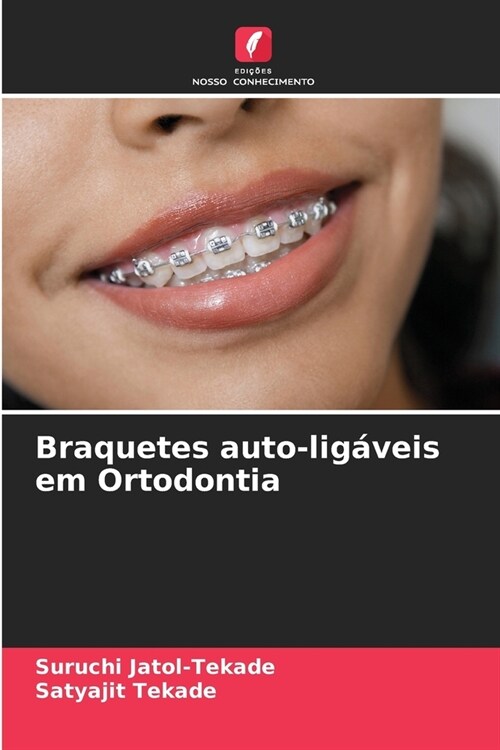 Braquetes auto-lig?eis em Ortodontia (Paperback)